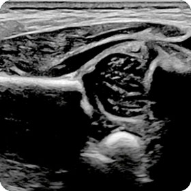 Sonographie vom Bewegungsapparat