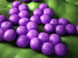 Infektiologie & Spitalhygiene