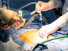 Onkologische Chirurgie