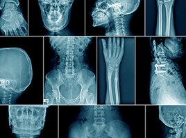 Modalitäts-Empfehlungen